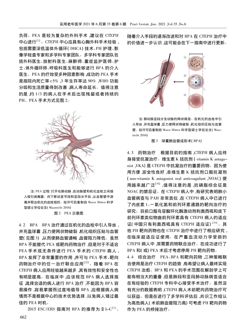 【呼吸领域】2020年《欧洲呼吸学会慢性血栓栓塞性肺动脉高压的专家共识》解读