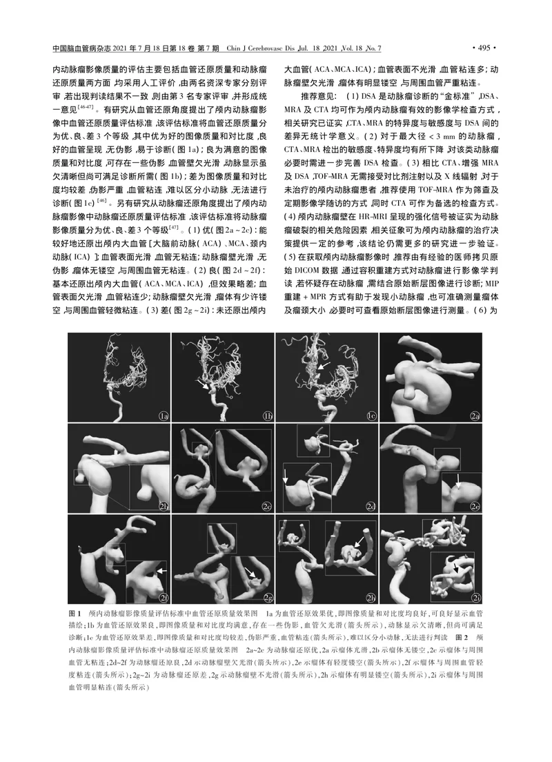 【神经领域】颅内动脉瘤影像学判读专家共识