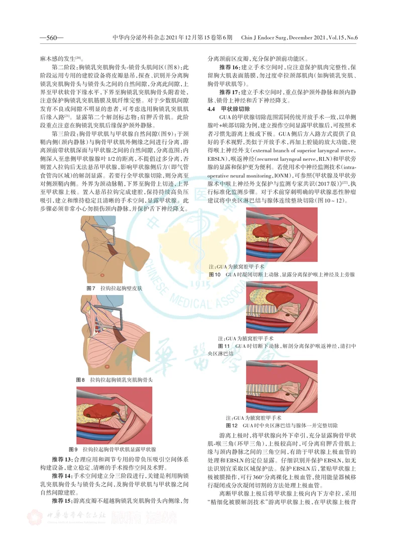 无充气腋窝入路腔镜甲状腺手术专家共识（2022版）
