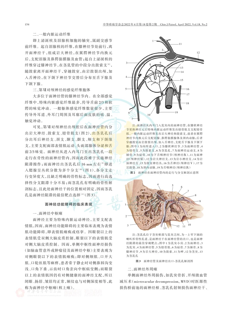 面神经阻滞技术在面神经功能障碍性疾病中的应用中国疼痛专家共识（2022版）