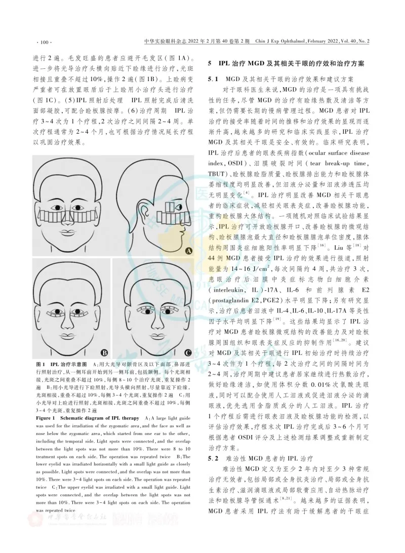 强脉冲光治疗睑板腺功能障碍及其相关干眼专家共识(2022)
