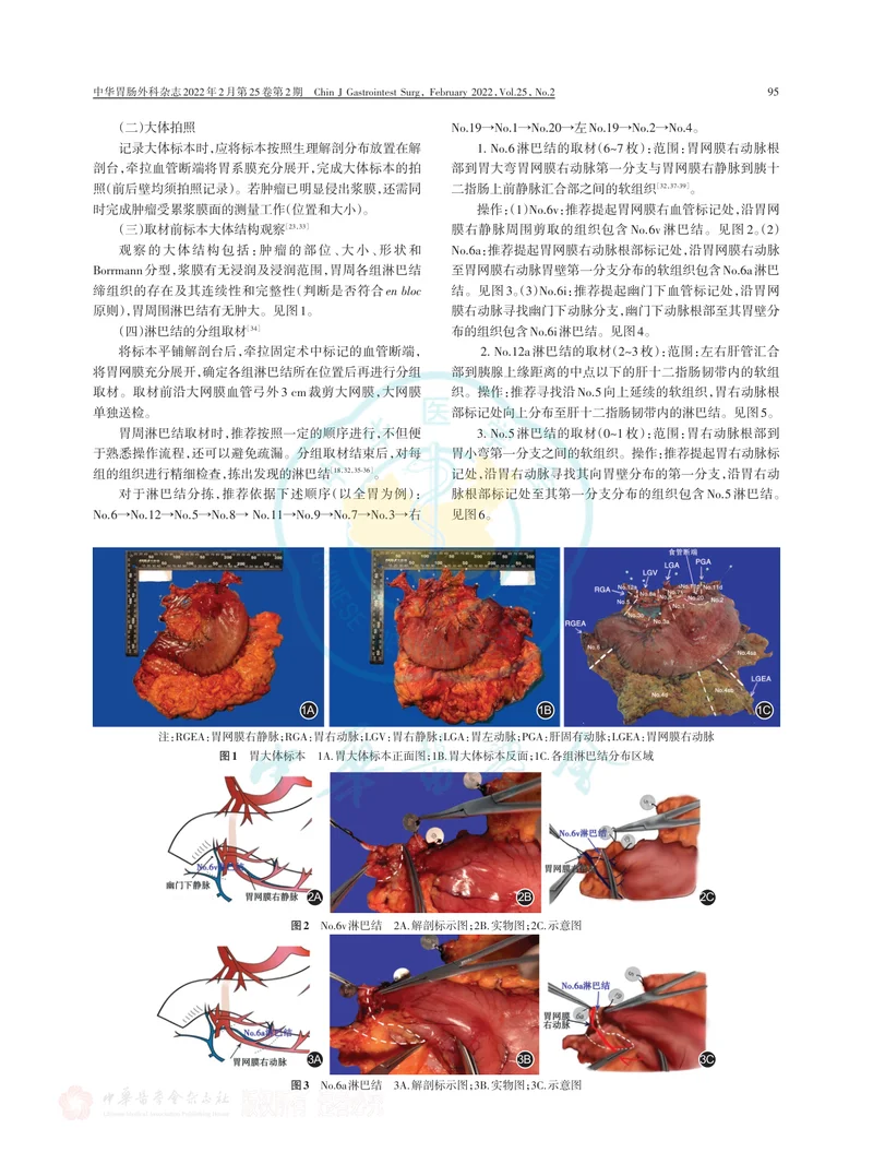 胃癌根治术标本的规范化外科处理中国专家共识（2022版）