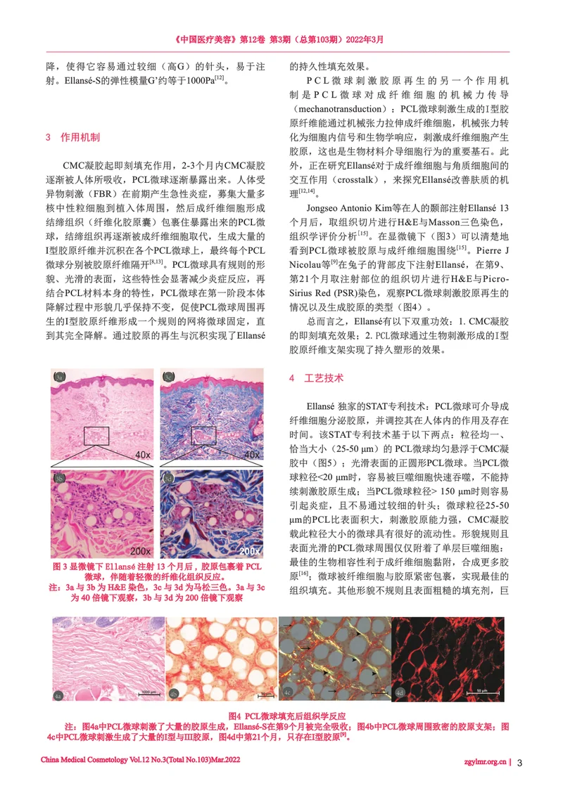 Ellansé 的材料特性及鼻唇沟填充的专家共识