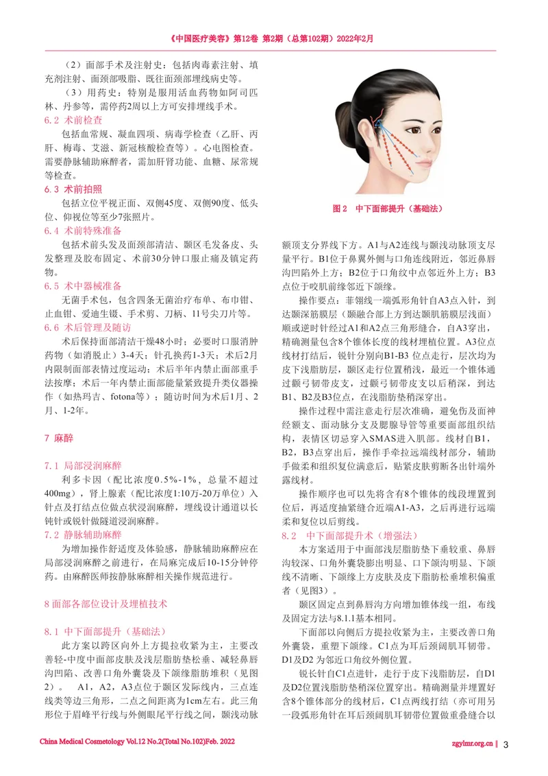 线技术操作专家共识之菲翎线（面部锥体提拉线）操作共识（2022版）