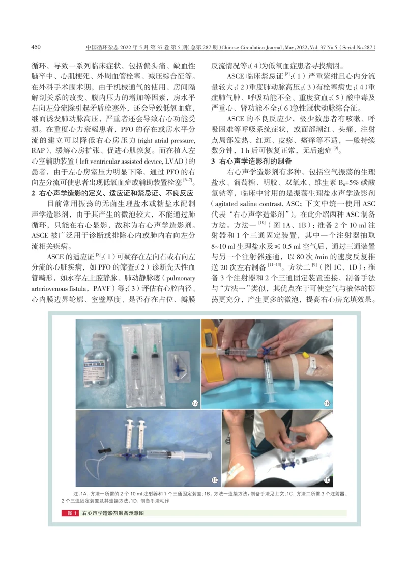 卵圆孔未闭右心声学造影中国专家共识