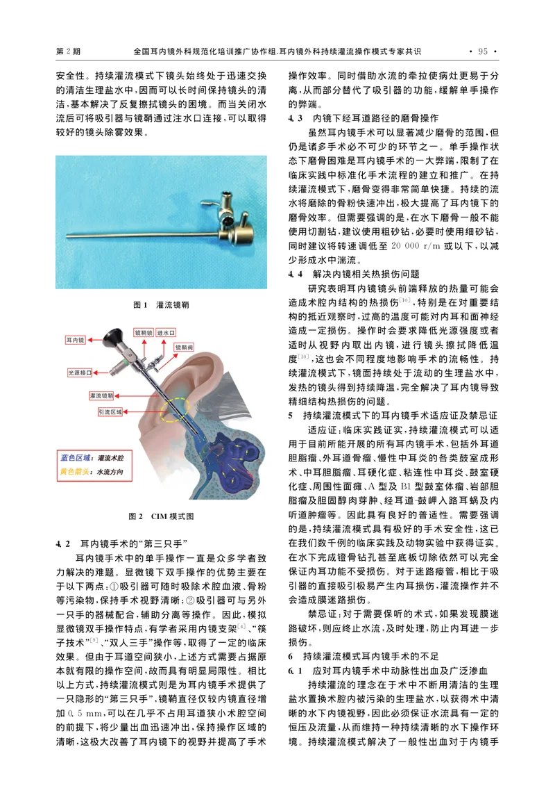 耳内镜外科持续灌流操作模式专家共识