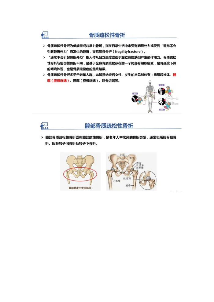 髋部脆性骨折术后抗骨质疏松药物临床干预指南