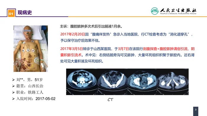 第十一章 案例分析-肠瘘、腹腔感染合并脓毒症