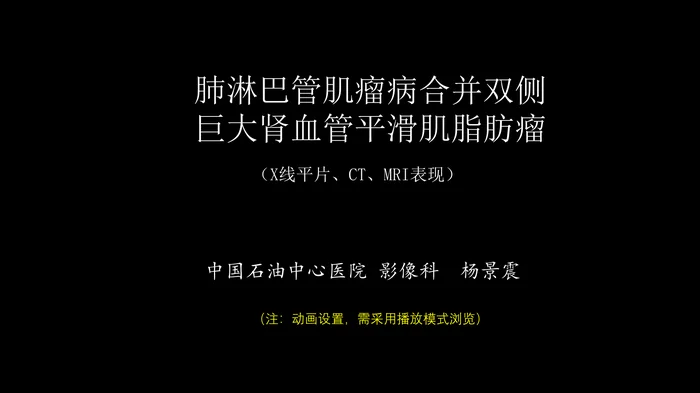 肺淋巴管肌瘤病合并双侧巨大肾血管平滑肌脂肪瘤(X线、CT、MR)