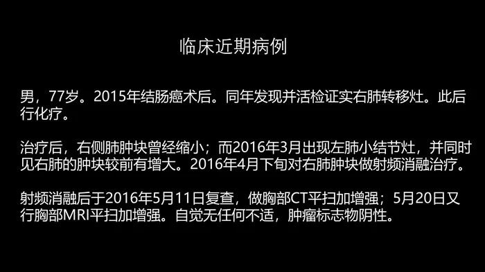 这例肺部病灶的比较影像学：价值评判