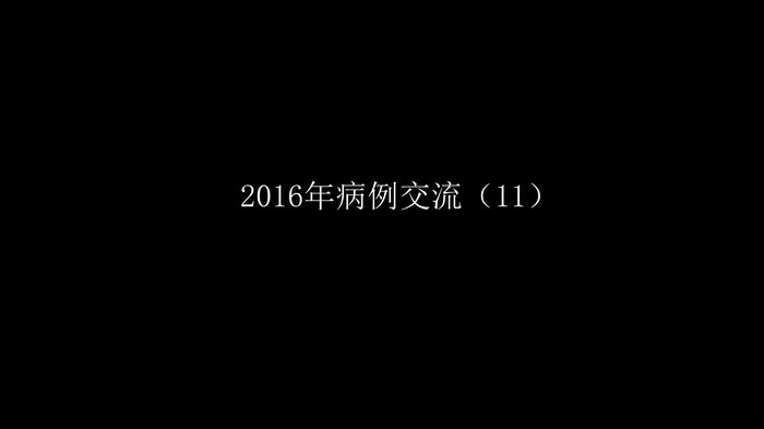 这样的肺隔离症：影像共享