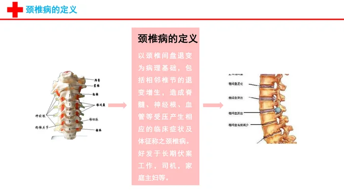颈椎病的护理查房_1