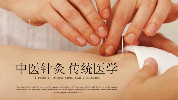 中医针灸 传统医学_1