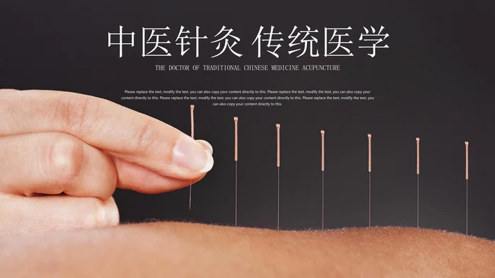 中医针灸 传统医学_2